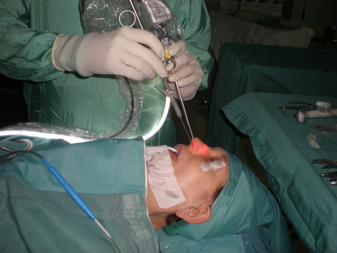 Fig.1.Tecnica two hands-two nostrils per la tubodilatazione con autonomia procedurale dell’operatore. Manipolo azzurro DRB  a risonanza quantica per lo shrinkage dell’ostio