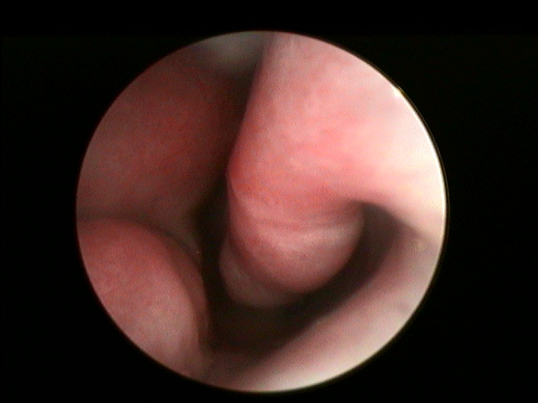 Fig.5 pre trattamento 