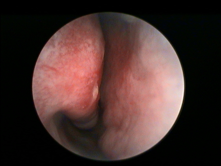 Fig.6 pre trattamento 