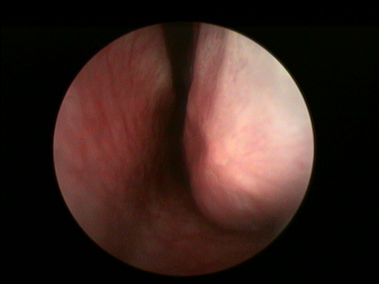 Fig.7 pre trattamento 