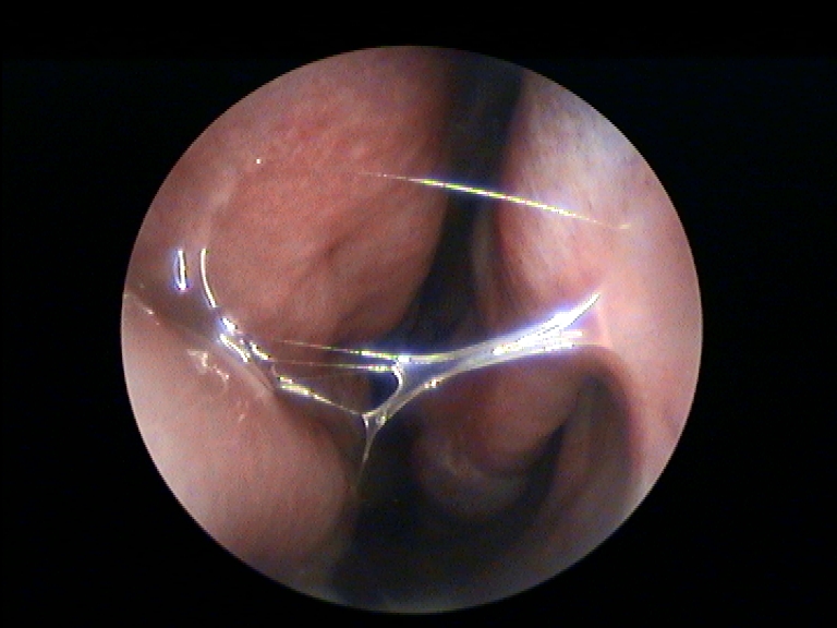 Fig.8 pre trattamento 